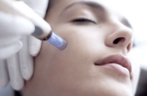 Microneedling Microneedling