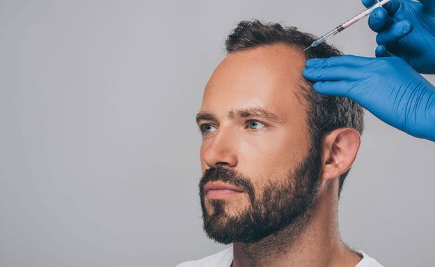 prp-cheuveux injections PRP